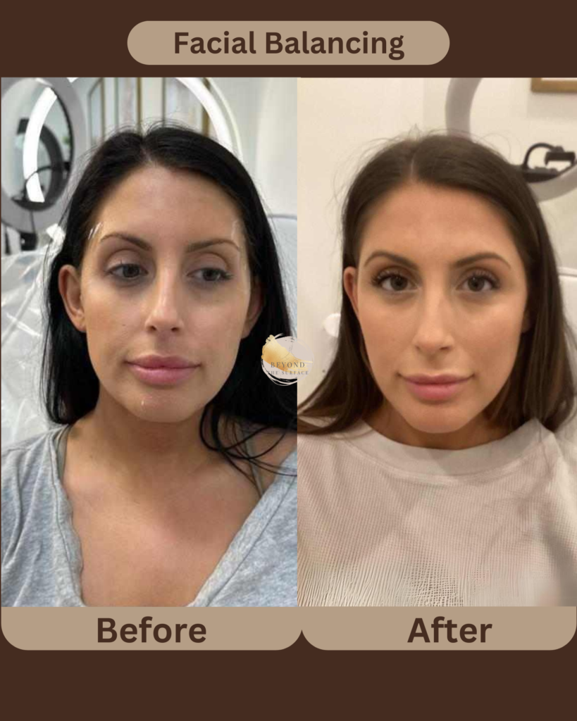 Facial Balancing | Edgewater, New Jersey