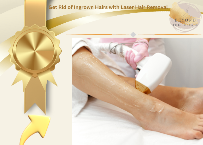 Laser Hair Removal Treatment