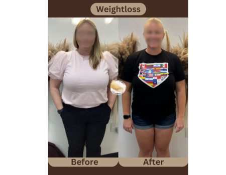 weight loss