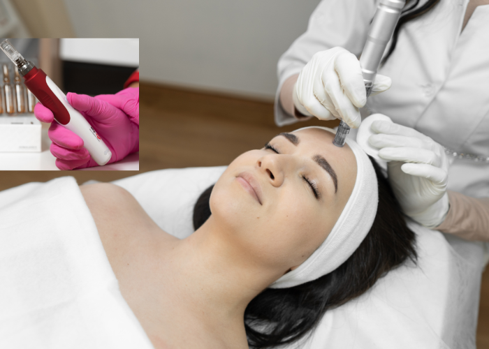microneedling cost