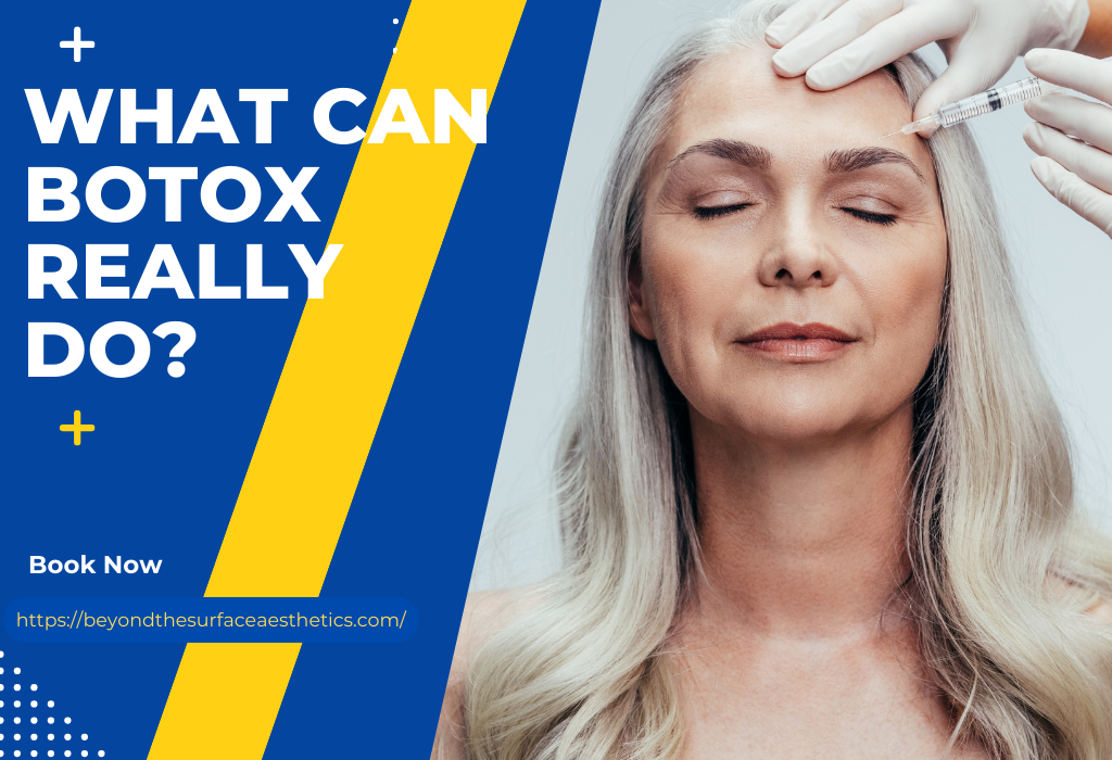 What Can Botox Really Do?