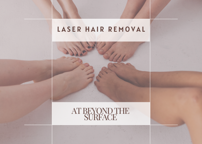 laser hair removal