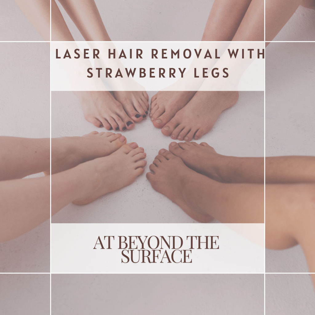 Laser Hair Removal Help with Strawberry Legs