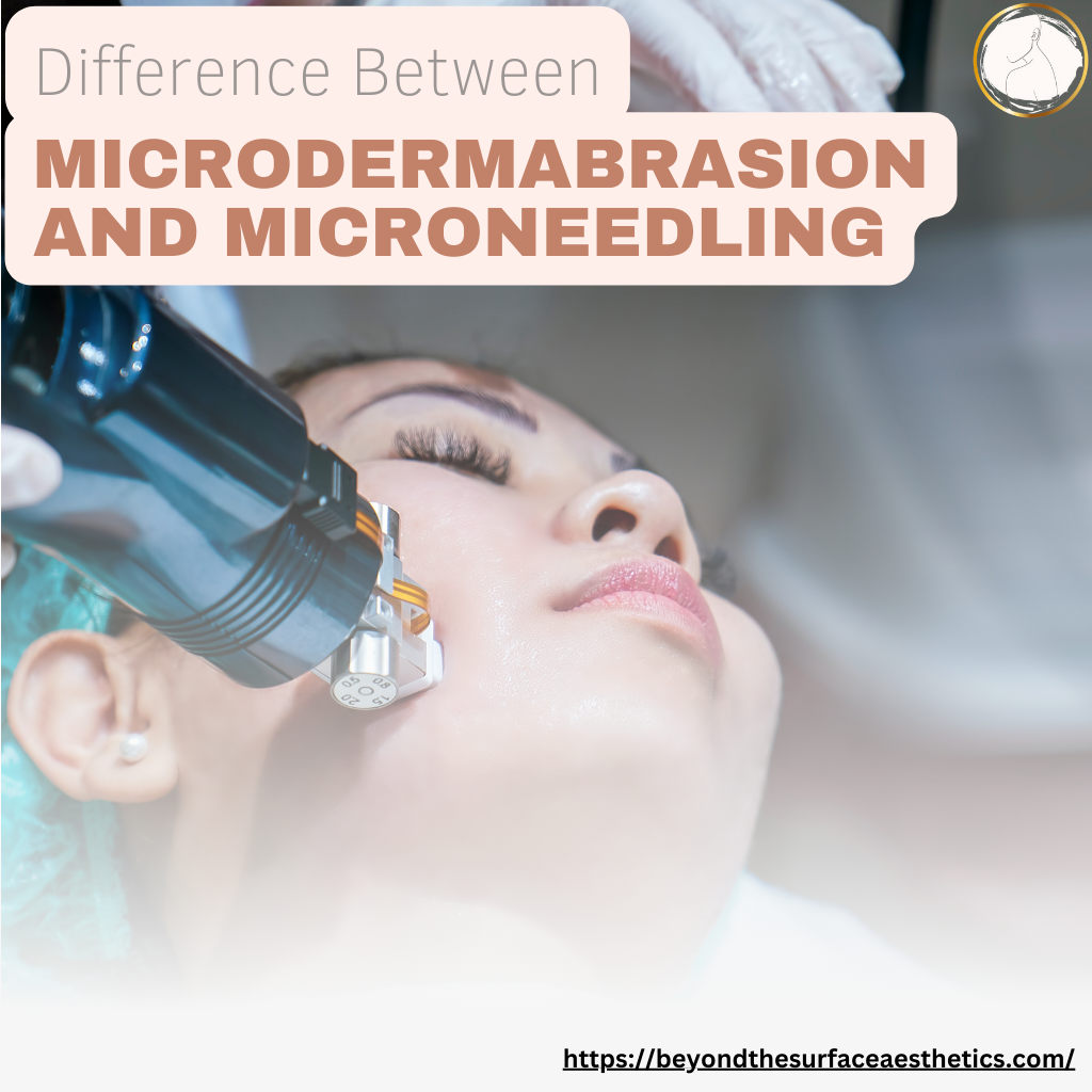 Difference Between Microdermabrasion and Microneedling - Beyond the Surface