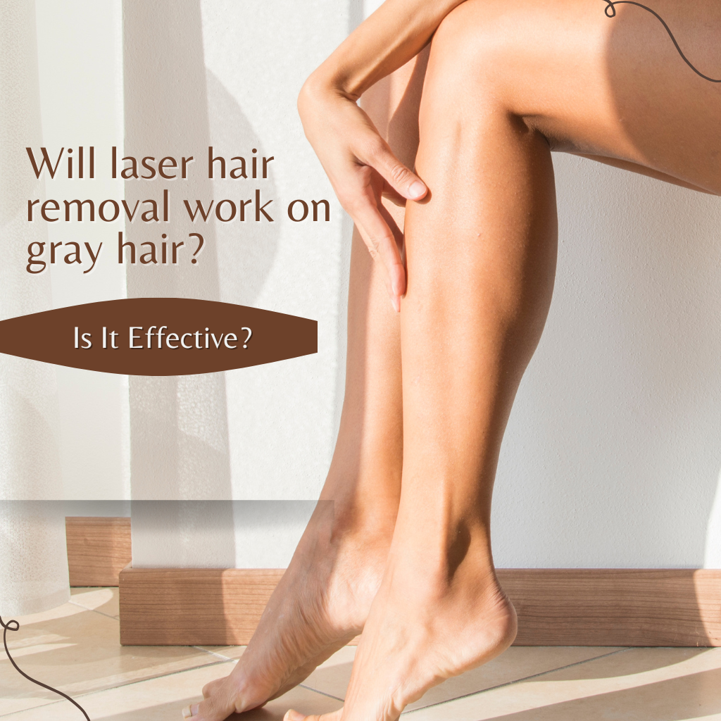 will laser hair removal work on gray hair