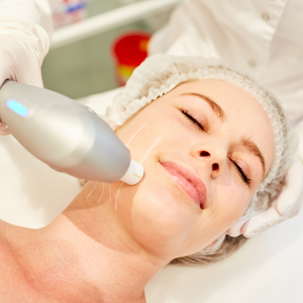 _Laser Treatments for Skin Tightening