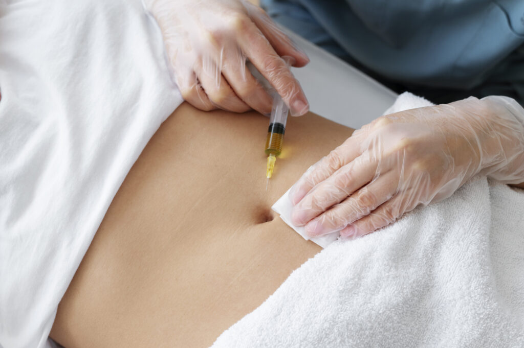 Weight Loss in Lyndhurst New Jersey
