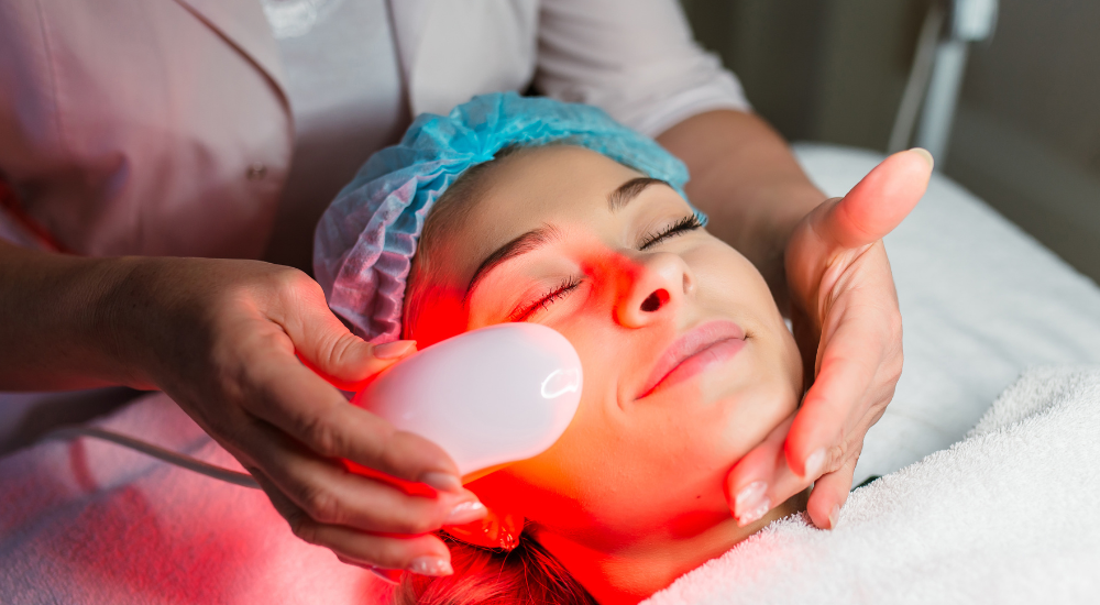 Laser Treatment for Dark Spots